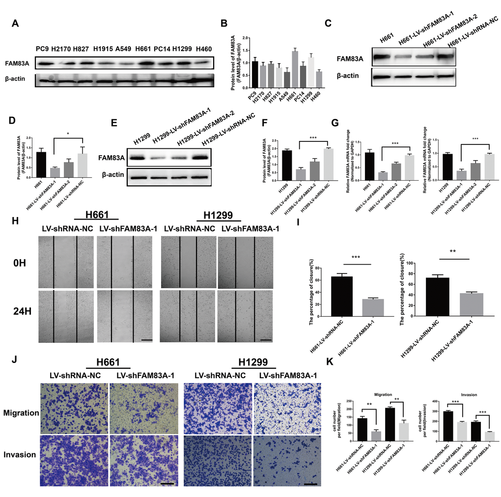 Suppression of FAM83A inhibited NSCLC cell migration and invasion capacity in vitro. (A) FAM83A protein level was assessed in NSCLC cell lines using Western blot analysis. β-actin was used as a loading control. (B) The intensity of protein levels was quantified using Image Lab 5.2.1 software and normalized to β-actin. (C–G) H661 and H1299 cells were transduced with FAM83A lentivirus (LV-shFAM83A-1/2) and a scrambled shRNA lentivirus (LV-shRNA-NC). The suppression of FAM83A in H661 and H1299 cells was confirmed at both the protein (C–F) and RNA (G) levels. (H–I) H661-shRNA-NC, H661-shFAM83A-1, H1299-shRNA-NC, and H1299-shFAM83A-1 cells were subjected to a wound-healing assay. Images were taken at 0 h and 24 h. (J–K) Transwell assays assessed tumor cell migration and invasion capacity in FAM83A-knockdown H661 and H1299 cell lines. Scale bar, 200 μm. Error bars: mean ± SD (n=3). *p