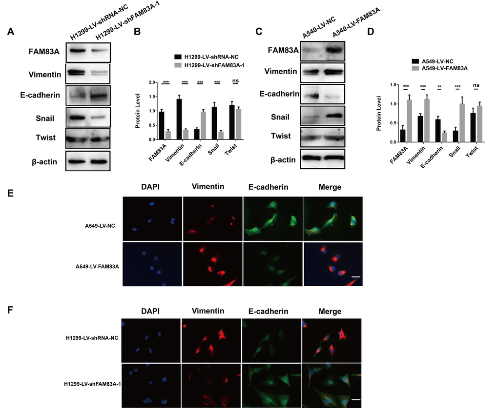 FAM83A facilitated NSCLC cell EMT progression. (A–D) Protein levels of FAM83A, Vimentin, E-cadherin, Snail, and Twist were detected by Western blot in stable H1299-LV-shRNA-NC, H1299-LV-shFAM83A-1, A549-LV-NC and A549-LV-FAM83A cells. β-actin was used as a loading control. (E–F) Immunofluorescence of Vimentin and E-cadherin in A549 and H1299 cells after manipulation of FAM83A expression. The nucleus was counterstained with DAPI. The fourth panel of each shows the merged image of the previous panels. Scale bar, 100 μm. Error bars: mean ± SD (n=3). NS, no significant, *p