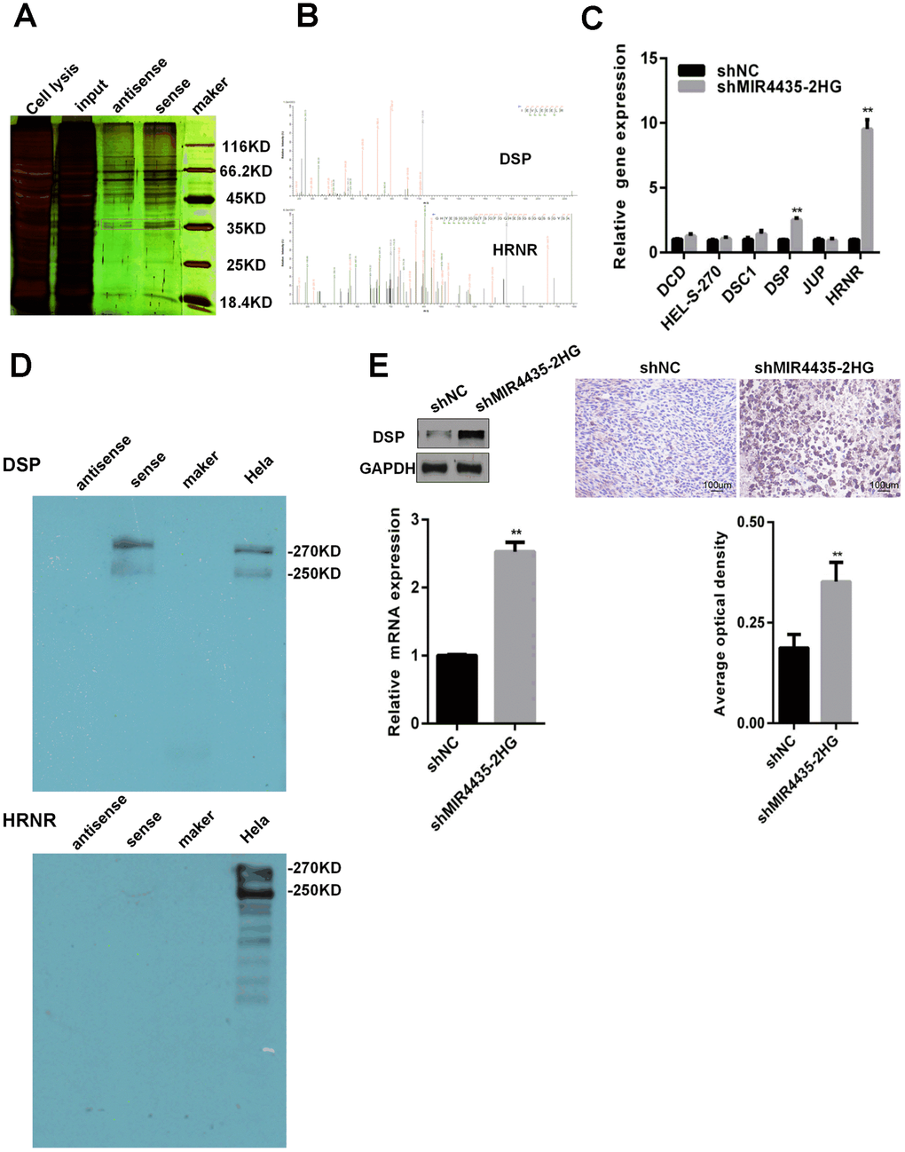 MIR4435-2HG binds to DSP protein and reduces DSP expression. (A) RNA pull-down experiments were performed to identify proteins interacting with MIR4435-2HG. Silver staining revealed a specific band associated with biotinylated sense MIR4435-2HG. (B) The biotinylated sense MIR4435-2HG band was excised, digested, and subjected to mass spectrometry, which identified DSP and HRNR as the MIR4435-2HG-interacting proteins. (C) Levels of DSP and HRNR were confirmed in the shMIR4435-2HG (HGC-27 cells) and control groups using RT-qPCR (**P D) The interaction of DSP with MIR4435-2HG or HRNR with MIR4435-2HG by RNA pull-down assay. DSP was detected within sense MIR4435-2HG pull-down protein complexes but not with antisense MIR4435-2HG. (E) Expression levels of DSP within HGC-27/shMIR4435-2HG-xenografted and HGC-27/shNC-xenografted tumors were detected using WB and IHC (**P 