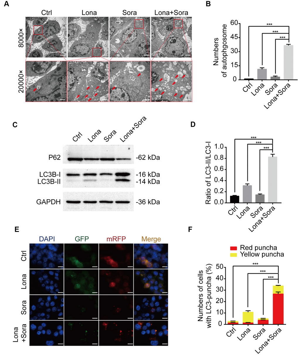 Lonafarnib combined with sorafenib induces autophagic flux. (A) Ultrastructural analysis showing autophagy induced by lonafarnib and sorafenib co-treatment in HepG2 cells. Red arrows indicated autophagosomes or autolysosomes. (B) The numbers of autophagosomes and autolysosomes were summarized and the data was presented as the means ± SD of triplicates. ***P C) Western blot analysis of protein levels of P62 and LC3B. Cells were treated as indicated. (D) The ratio of LC3B-II/LC3B-I according to western blot results above. ***P E) Detection of autophagic flux using mRFP-GFP-LC3 reporter in HepG2 cells after treatment with lonafarnib (10 μM) and/or sorafenib (5 μM) for 48 h. Microscopy images merged with GFP, RFP and DAPI fluorescence of representative cells. Scale bar = 10 μm. (F) The percentages of red (mRFP+ and GFP-, autolysosomes) and yellow (mRFP+ and GFP+, autophagosomes) were calculated. ***P 