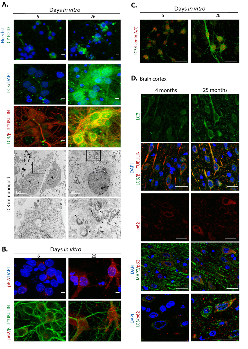 Autophagosomes accumulate during neuronal senescence. (A) Top row, autophagosomes were stained with CytoID® and nuclei with Hoechst in primary culture of cortical cells incubated during the indicated DIV; scale bars represent 15 μm. Middle rows, immunofluorescence to detect LC3 in neurons (expressing βIII-TUBULIN) of primary cortical cells cultivated during the indicated DIV. Scale bars represent 5 μm. Bottom rows, electron micrographs showing accumulation of autophagosomes in 26 DIV cortical cells, detected by immunogold localization of LC3 (arrow heads). Squares indicate the amplified area below. (B) Immunofluorescence to detect p62/SQSTM1 in cortical cells cultured during the indicated DIV. Nuclei were stained with DAPI. Notice that p62/SQSTM1 in neurons (expressing βIII-TUBULIN) accumulated at 26 DIV. Scale bars represent 5 μm. (C) Immunofluorescence to simultaneously detect LC3 and Lamin-A/C to observe intranuclear folds as a senescence marker, in cortical cells cultured during the indicated DIV. Scale bars represent 25 μm. (D) LC3 and p62/SQSTM1 also accumulate in cortical neurons (expressing βIII-TUBULIN or MAP2) form old rat brains. Scale bars represent 30 μm.