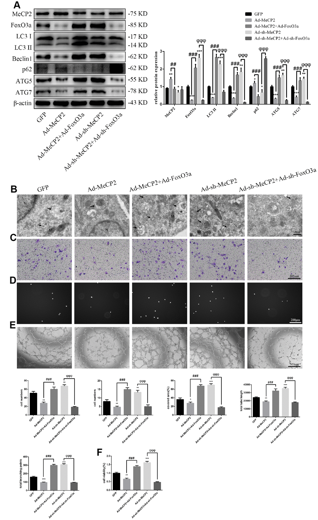 MeCP2 inhibits autophagy and EPC function through FoxO3a. (A) Protein levels of MeCP2, FoxO3a, LC3 II, Beclin1, p62, ATG5, and ATG7 were detected by western blotting after transfection with Ad-MeCP2 or Ad-sh-MeCP2 or co-transfection with Ad-FoxO3a or Ad-sh-FoxO3a for 48 h. (B) EPC ultrastructure was imaged by TEM. The white arrow indicates autophagosomes. N, nucleus; M, mitochondria. (C) Cell migration was evaluated by Transwell migration assays after transfection or co-transfection for 48 h. (D) Cell adhesion ability was evaluated by matrix adhesion assay after transfection or co-transfection for 48 h. (E) Angiogenic ability was evaluated by Matrigel assays after transfection or co-transfection for 48 h. (F) Cell viability was evaluated with CCK-8 after transfection or co-transfection for 48 h. *P #P ##P ###P φP φφP φφφP 