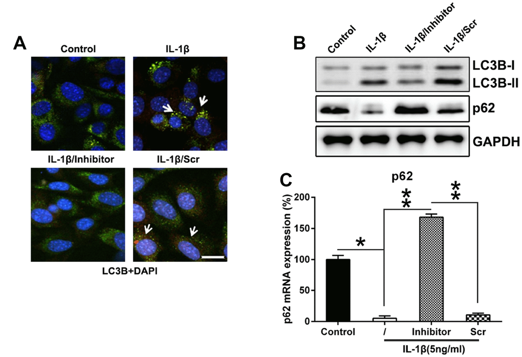 Downregulation of miR-27a expression repressed the autophagy in IL-1β-triggered chondrocytes. (A) Twenty-four well plates were used to culture IL-1β-supplemented chondrocytes. The cells were first co-transfected for 36 h with the GFP-LC3B construct, as well as the miR-27a inhibitor/miR-Scr. The cellular location of GFP-LC3B was then evaluated via IFA (magnification, ×400). (B) WB was used to analyze the expression levels of LC3B and p62 in IL-1β-supplemented chondrocytes transfected with the miR-27a inhibitor. (C) Q-PCR was used to analyze the mRNA expression of p62 in IL-1β-treated chondrocytes transfected with the miR-27a inhibitor. The results were described as the mean ± SD. *P 