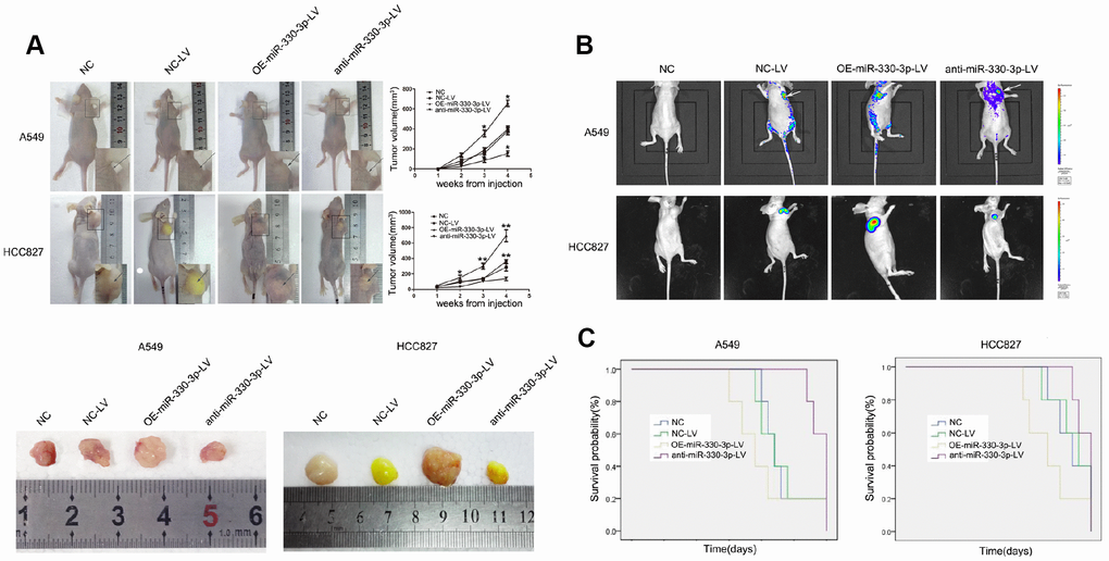 MiR-330-3p induces tumorigenesis in vivo. (A) A549 and HCC827 cells stably transfected with NC-LV, OE-miR-330-3p-LV or anti-miR-330-3p-LV were injected subcutaneously into nude mice. Four weeks after the injection, mice were photographed and killed. Tumor growth curves were obtained. (B) Representative bioluminescence images of tumor burden in the mice that received subcutaneous injection of indicated cells. (C) Survival curves represent the duration from injection until four weeks when mice were killed. *P P 