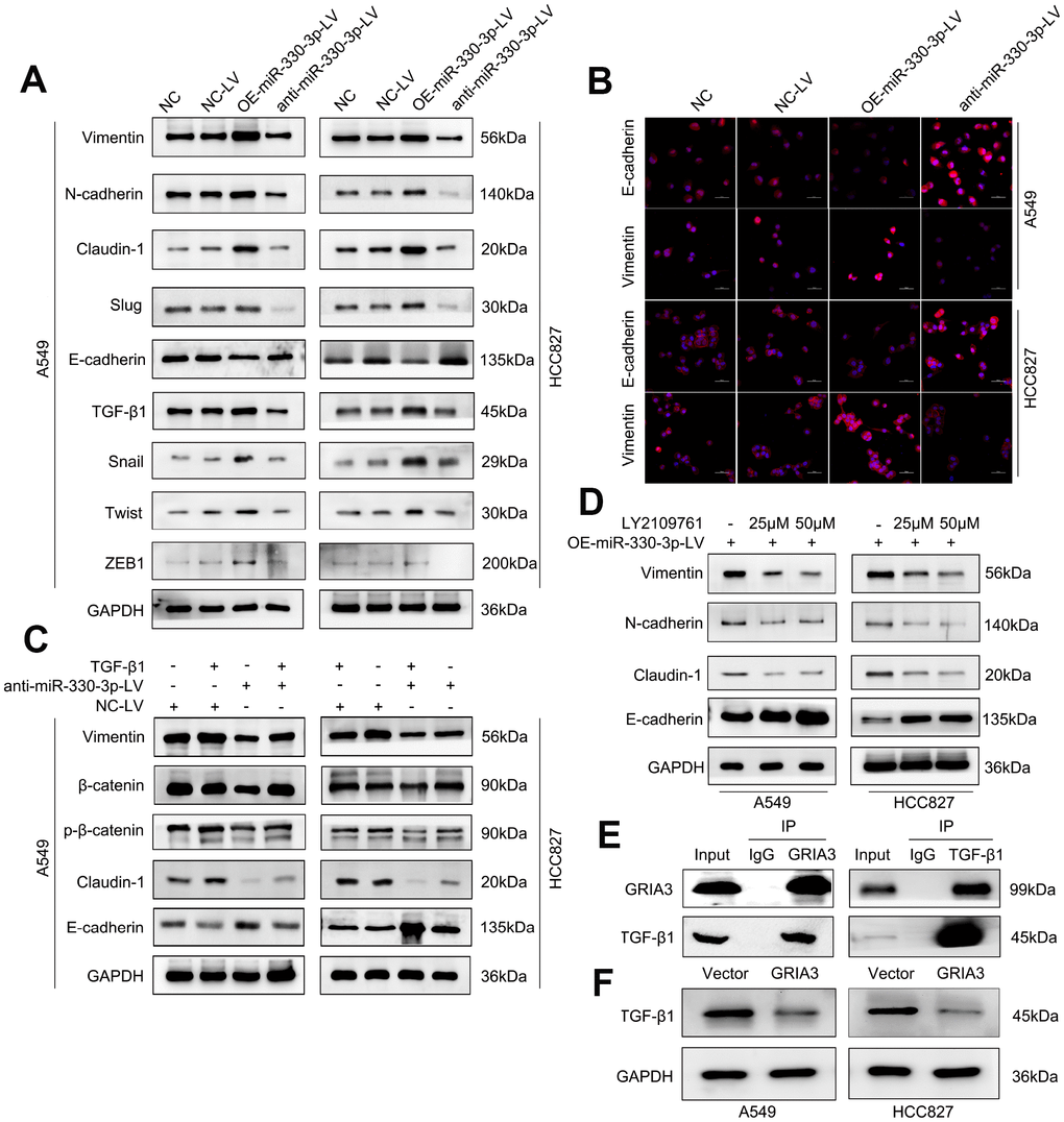 MiR-330-3p promoted NSCLC cells migration and invasion via TGF-β-induced EMT process. (A) Western blotting analysis of EMT related protein levels in the indicated cells. miR-330-3p could increase mesenchymal phenotypic biomarkers expression and decrease E-cadherin expression. (B) Immunofluorescence staining detected the Vimentin and E-cadherin expression in A549 and HCC827 cells. (C, D) Western blotting analysis of EMT associated protein expression in A549 and HCC827 cells treated with recombinant TGF-β1 (C) and the TGF-β1 inhibitor LY2109761 (D), respectively. (E) Co-IP and Western blotting indicating the endogenous interaction between GRIA3 and TGF-β1 protein in HCC827 cells. (F) Western blotting analysis evaluated TGF-β1 expression in A549 and HCC827 cells overexpressing GRIA3.