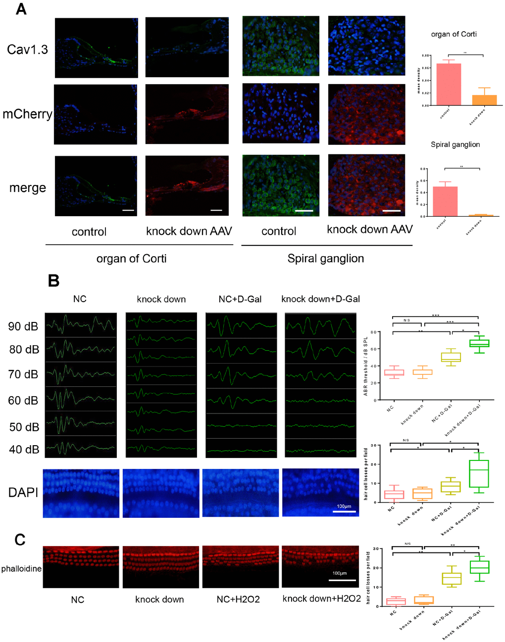 Cav1.3 knock down aggravated the loss of hair cells after senescence induction and resulted in hearing impairment. (A) immunofluorescence of CaV1.3 (green) and mCherry (red) in the organ of Corti (left) and spiral ganglion (right) of control and CaV1.3 knock down AAV group, nuclei was visualized by DAPI (magnification, ×400, scale bar: 50μm), the right panels are the quantitative analysis of CaV1.3 expression in organ of corti (top) and spiral ganglion (bottom). (B) auditory brainstem response (ABR) (top) and the whole cochlear basilar membrane after DAPI staining (bottom) of NC, CaV1.3 knock down, NC+D-Gal and CaV1.3 knock down+D-Gal group (n=6). (C) phalloidine staining for control and negative control AAV or Cav1.3 knock down AAV infected OC segment explants with H2O2 treatment (n=3), the right panel is the quantitative analysis. Error bars represent mean ± s.d.; *PB, C).