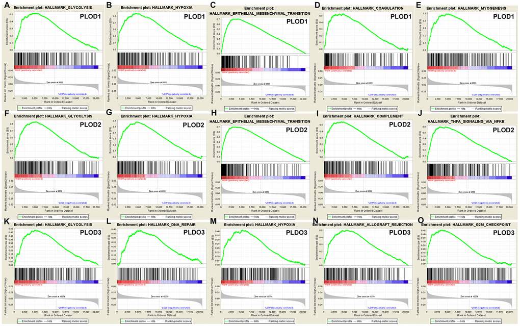 GSEA was used to perform hallmark signaling analysis in PLOD1/2/3, respectively. A total of 100 significant genes were obtained from GSEA with positive and negative correlation. The most involved significant pathways included glycolysis, hypoxia, epithelial mesenchymal transition, etc.