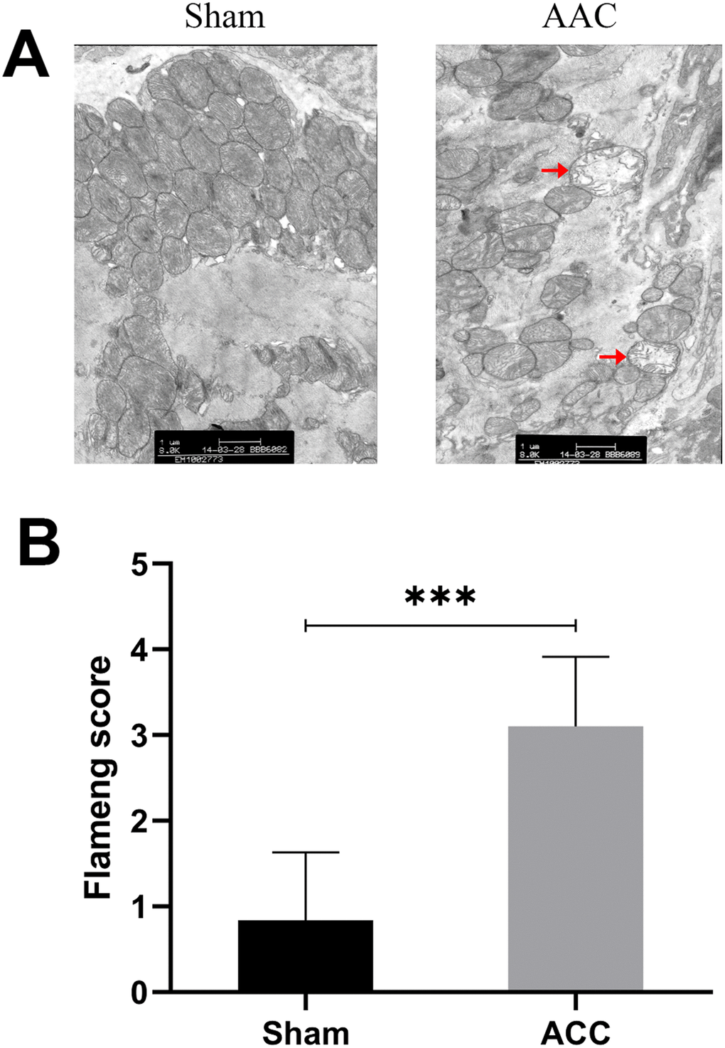 Myocardial cell ultrastructure. In sham group myocardia, mitochondrial membranes and matrix particles were typically intact, and the mitochondrial ridge was usually continuous. In AAC group myocardia, mitochondrial swelling, matrix loss, and even vacuolation were observed. The inner and outer membranes were also damaged and incomplete.