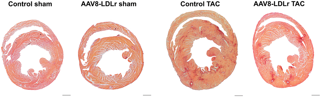 Representative Sirius Red-stained cross-sections of sham hearts and TAC hearts at day 56 after operation. Scale bar represents 1 mm.