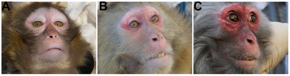 Scored facial redness in the scale on aging-related health and functioning. Perceived age was rated by darkness of facial redness on the present scale on aging-related health and functioning in rhesus macaques. Representative animals scored 1, 2 and 3 are shown in A, B and C, respectively. Reduced aging-related health and functioning was supposed to be in parallel to the increased darkness of facial redness. The high interrelationship of items in the scale indicated both convergent and discriminate validity.