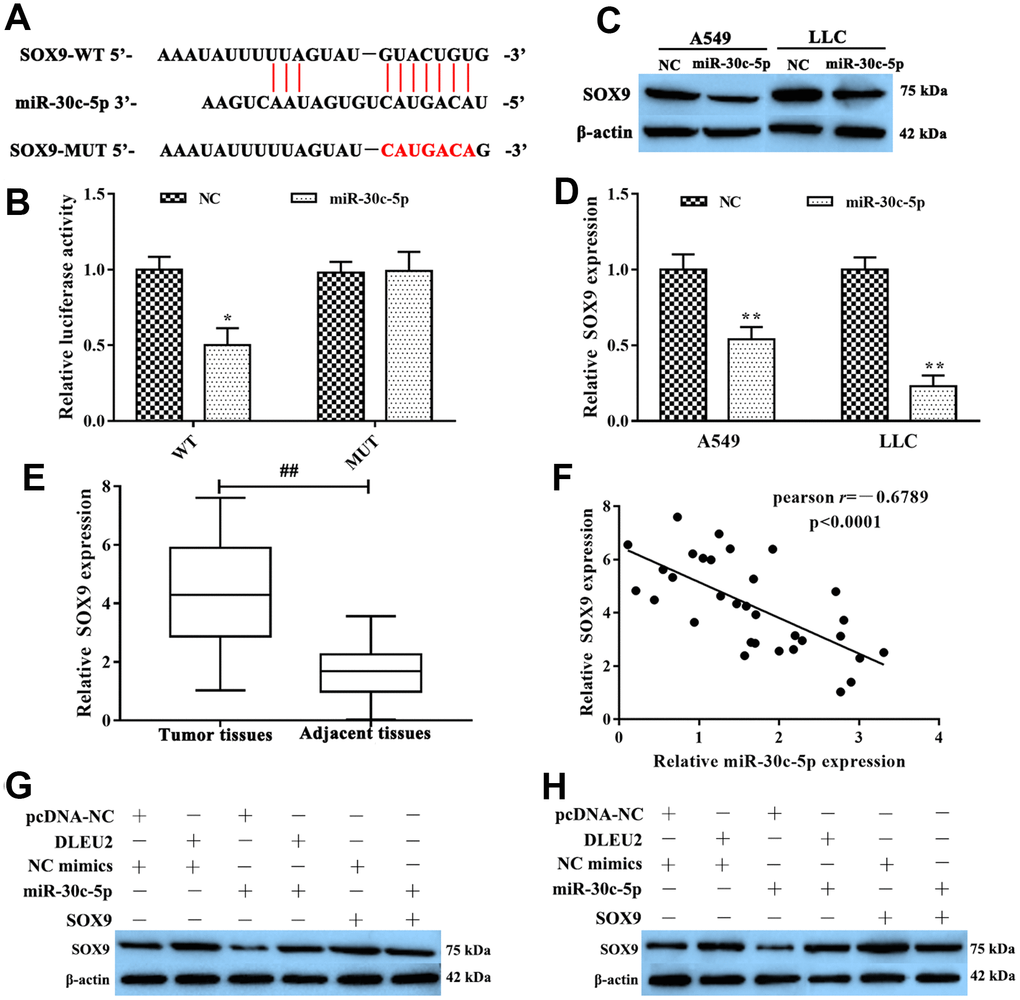 SOX9 was the target of miR-30c-5p. (A) The bioinformatics analysis result showed that miR-30c-5p had a binding site with SOX9; (B) Dual-luciferase reporter gene assay was used to confirm the target relationship between miR-30c-5p and SOX9; (C–D) The expression of SOX9 mRNA was detected by qRT-PCR and western blotting in A549 and LLC cells which were transferred with miR-30c-5p; (E) qRT-PCR was used to determine the expression of SOX9 in NSCLC tissues and adjacent tissues; (F) The expression relationship between miR-30c-5p and SOX9 was evaluated by Spearman’s correlation analysis; (G–H) Western blotting was applied to detect the expression of SOX9 protein in A549 and LLC cells. *p**p##p