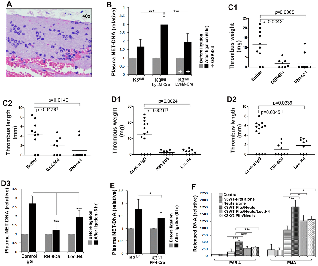 Determine the role of kindlin-3 in platelets and neutrophils in regulating NET release in vivo and in vitro. (A) Histological analysis of the thrombi formed in the IVC in Kindlin-3fl/flLysM-Cre mice after partial ligation for 6 hours. (B) The levels of NETs in plasma were measured using an ELISA-based assay as described in methods. Data are shown as mean ± SD; n ≥ 8 for each group. (C1–C2) Kindlin-3fl/flLysM-Cre mice were injected with DNase I, GSK484 or buffer, and the partial IVC ligation was performed. Thrombus formation in the IVC was determined 6 hours after the ligation. Dots represent individual experiments for each mouse and lines in dot plots represent mean; n ≥ 8 for each group. (D1–D3) After treatment with the indicated antibodies, Kindlin-3fl/flLysM-Cre mice were subjected to partial IVC ligation for 6 hours and then the IVC tissues were harvested and evaluated (D1–D2). Dots represent individual experiments for each mouse and lines in dot plots represent mean; n ≥ 8 for each group. Meanwhile, blood samples were collected from mice before and after the IVC stenosis and used for measuring plasma NETs by the ELISA-based assay. Data are shown as mean ± SD. (E) blood samples were collected from Kindlin-3fl/flPF4-Cre mice and Kindlin-3fl/fl mice before and after the IVC stenosis and used for measuring plasma NETs by the ELISA-based assay (D3). Data are shown as mean ± SD. (F) Mouse bone marrow neutrophils (Neuts) were incubated with TNF-α primed endothelial cell monolayers with or without the presence of washed platelets isolated from either Kindlin-3fl/fl mice (K3WT-Plts) or Kindlin-3fl/flPF4 mice (K3KO-Plts). After stimulation with either PAR4 agonist peptide (150 μM) or PMA (20 nM) for 2 hours in the presence or absence of Leo.H4 antibody, the released NETs were quantified as described in methods. Data are shown as mean ± SD. (*, p; ***, p).