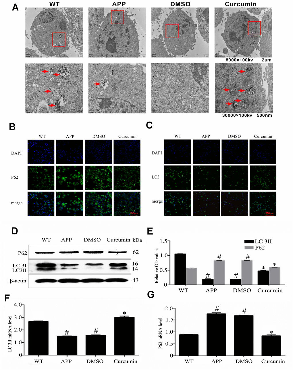 Curcumin induced autophagy in N2a/APP695swe cells. (A) Lesser and greater magnification transmission electron microscopy images for the whole cell body of each group. Arrows denote autophagic lysosomes and autophagosomes. (B) P62 and (C) LC3 immunofluorescence were used to measure the level of autophagy. Bar=100 μm. (D–E) Western blot analysis of LC3II, and p62 in each group. (F–G) Relative mRNA expression of (F) LC3 and (G) P62 of each group; The data represent as mean ± SEM of a typical series of 3 experiments (# P