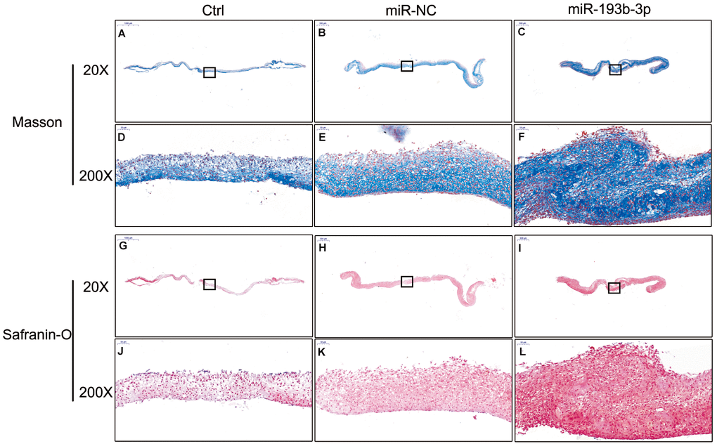 In vitro masson and safranin-O staining of the chondrocyte sheets in different groups (n=3). (A–C) Masson staining magnification 20 times (bar 500 μm). (D–F) Zoom square magnification x200; bar 50 μm. (G–I) Safranin-O staining magnification 20 times (bar 500 μm). (J–L) Zoom square magnification x200; bar 50 μm.