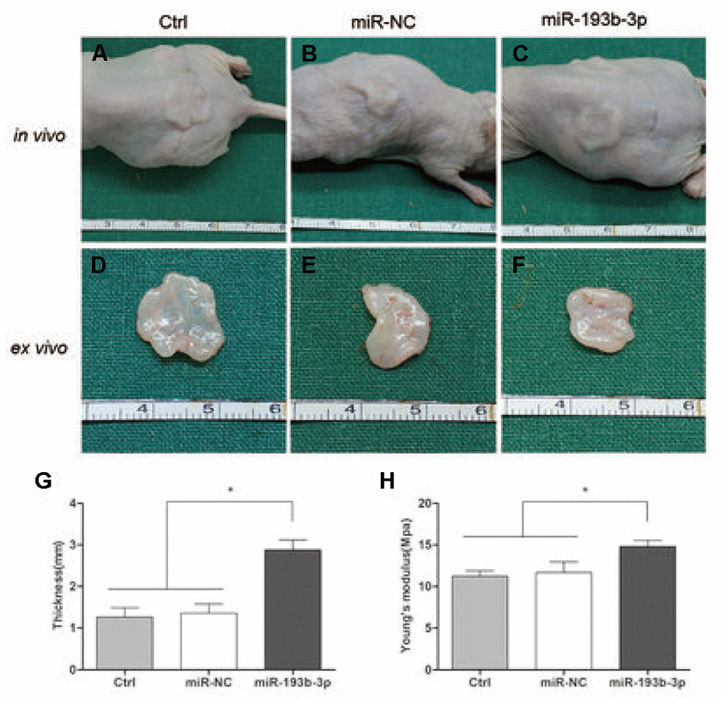 In vivo cartilage regeneration of the cell sheets after 8 weeks. (A–C) Subcutaneous gross view of cell sheets in nude mice after eight weeks of transplantation. (D–F) Gross view of cartilage tissue ex vivo (G) Thickness of cartilage tissue. (H) Young’s modulus of cartilage tissue (n=3).