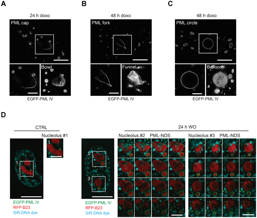 Three-dimensional reconstruction of structural subtypes of PNAs. High resolution live-cell structured illumination microscopy of the cap- (A), fork- (B) and circle-like (C) PNAs of RPE-1hTERT cells stably expressing the EGFP-PML IV isoform harvested 24 and 48 hours after doxorubicin-treatment. Central layer of the whole cell (upper images; bar, 5 μm) and central layer of respective type of PNAs (lower-left images; bar, 2 μm) are shown together with reconstructed 3-D images (lower-right images) from 28 (cap), 30 (fork) and 54 (circle) layers using ImageJ 3D viewer plugin. (D) High resolution live-cell SIM images of RPE-1hTERT stably expressing EGFP-PML IV and RFP-B23. A control untreated cell (left) and a cell containing PML-NDS, imaged 24 hours after doxorubicin washout (right). The central layer of whole cells (bar, 10 μm) are shown together with three insets of nucleoli (1 layer for the nucleolus of control cell and 16 layers for the nucleoli with adjacent PML-NDS; bar, 4 μm). DNA was labeled with SiR-DNA dye.