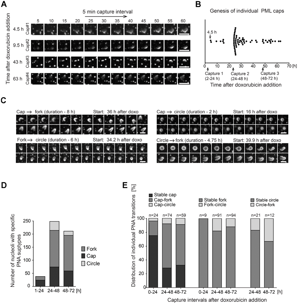 Structural transitions of PNAs subtypes. RPE-1hTERT stably expressing EGFP-PML IV were analyzed by live-cell imaging in three consecutive capturing sessions spanning 2–24, 24–48 and 48–72 hours after doxorubicin treatment (0.75 μM). (A) Series of sequential images of four individual cap formations (cap#1–4) that initiated 4.5, 9.5, 43 and 63 hours after doxorubicin addition. (B) Plot of all genesis of PML-caps recorded during three capturing intervals. Dots represent de novo formation of individual PML-caps. (C) Time-dependent evolution and transition of subtypes of PNAs. The four characteristic transitions – 'cap-to-fork', 'cap-to-circle', 'fork-to-circle' and 'circle-to-fork' – are represented by series of sequential images. The initiation of capturing and the length of recorded time (in parentheses) are given for each type of transition. (D) The quantitative distribution of specific subtypes of PNAs in three capturing sessions (see Figure 1B for comparison). (E) The quantitative distribution of specific PNAs subtype transitions in three capturing sessions. The PNAs that did not change for over 5 hours were considered as stable. Bars, 4 μm.