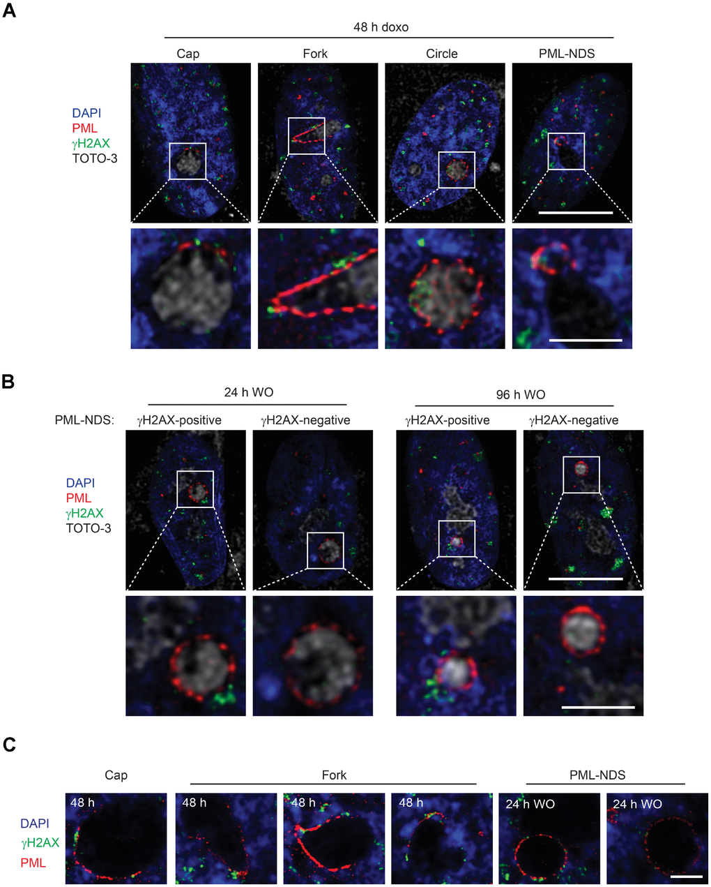 PNAs colocalize with persistent DNA damage foci. Co-association of DNA damage foci and PNAs detected by γH2AX (green) and PML (red) immunostaining, respectively, in RPE-1hTERT treated with 0.75 μM doxorubicin for 48 hours (A) and 24 and 96 hours after drug removal (B). Higher magnifications of confocal microscopic images of PML/γH2AX co-associations (insets) are shown in the lower rows. Bars, 10 μM for the whole cells and 3 μM for the insets. (C) High resolution STED microscopic images of PNAs/γH2AX co-associations in RPE-1hTERT treated with 0.75 μM doxorubicin for 48 hours and followed for PML-NDS appearance 24 hours after drug removal (WO). Nuclei are stained with DAPI (blue). Bars, 4 μM.