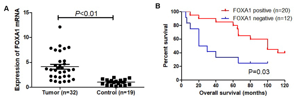 FOXA1 as a prognosis marker in breast cancer. (A) Expression of FOXA1 in tumor (32 cases) and adjacent normal mammary epithelium (19 cases). (B) Kaplan-Meier curves based on FOXA1 expression were drawn for overall survival in 32 patients.