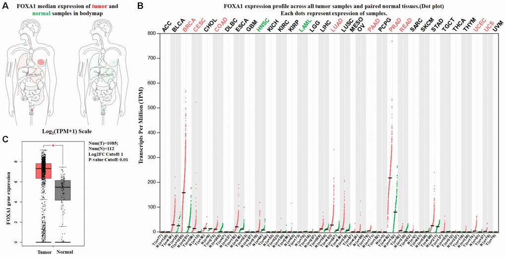 Expression of FOXA1 in breast cancer and normal tissues from GEPIA. (A) FOXA1 median expression of tumor (red) and normal (green) samples in bodymap. (B) FOXA1 epxression profile across all tumor (red) and paired normal (green) tissues. Each dot represents the expression of sample. (C) The expression of FOXA1 mRNA in breast cancer tissues (red box) and paired normal tissues (black box) from GEPIA.