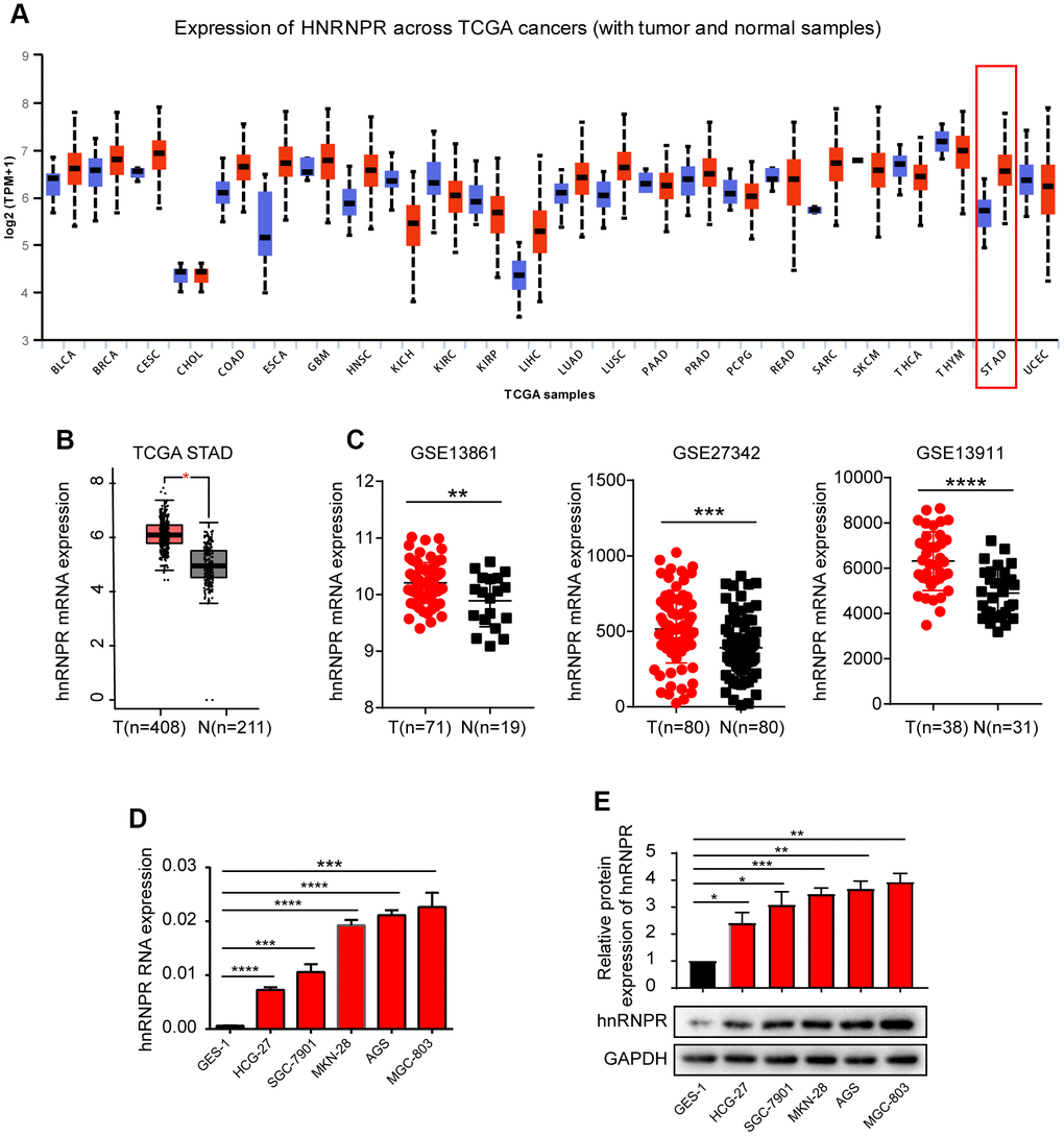 hnRNPR was overexpressed in gastric cancer cell lines and patients. (A) The bioinformatics analysis revealed that hnRNPR was upregulated in stomach tissues compared to normal tissues. (B) The GEPIA dataset indicated that the level of hnRNPR in cancer tissues was higher compared to that in normal tissues. T(Tumors)=408; N(Normal)=211. (C) Three GEO database (GSE13861, GSE27342, GSE13911 from GEO database) revealed that the expression of hnRNPR was significantly higher in tumors compared with normal tissues. (D) The relative mRNA level of gastric cell lines (SGC-7901, AGS, HGC-27, MKN-28, MGC-803) were elevated than in normal epithelial cell line GES-1. GAPDH served as the internal control. (E) The protein level of hnRNPR in gastric cell lines were higher than in normal cell lines GES-1. GAPDH served as the internal control. Each experiment was performed in triplicate and repeated three times. P values were calculated with two-tailed unpaired Student’s t test. *, P