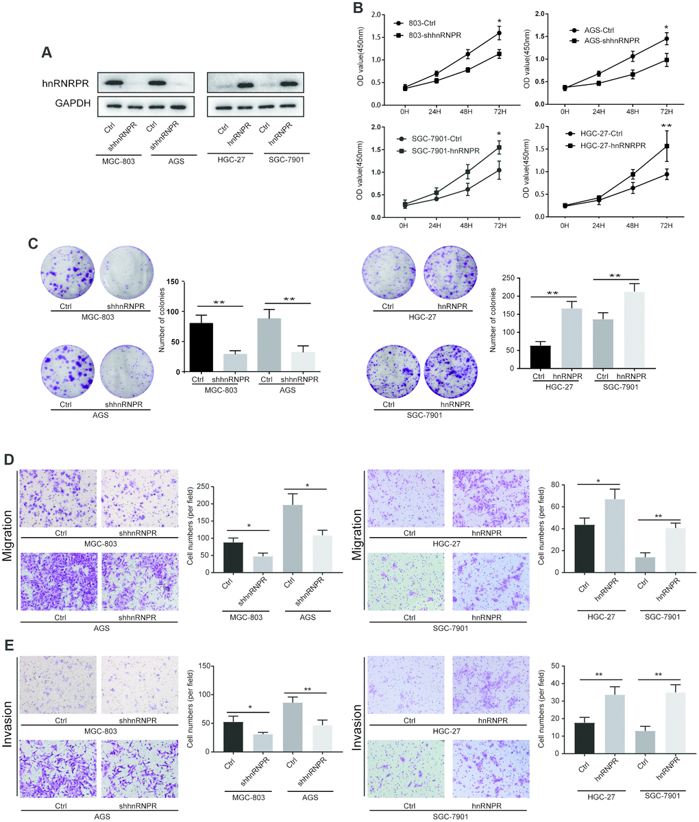 hnRNPR promoted cell proliferation, migration and invasion of gastric cancer cells. (A) The efficiency of hnRNPR knockdown or overexpression was detected by western blot in the indicated cells after transfection with shhnRNPR or plasmids. GAPDH serve as the internal control. (B) CCK8 and (C) colony formation assays showed that hnRNPR knockdown suppressed cell growth in MGC-803 and AGS, while overexpression of hnRNPR promoted cell proliferation in HGC-27 and SGC-7901. (D) Migration assays and (E) invasion assays revealed that hnRNPR inhibition decreased cell migration and invasion abilities of MGC-803 and AGS, and hnRNPR overexpression increased cell migration and invasion abilities in HGC-27 and SGC-7901. Each experiment was performed in triplicate and repeated three times. P values were calculated with two-tailed unpaired Student’s t test. *, P