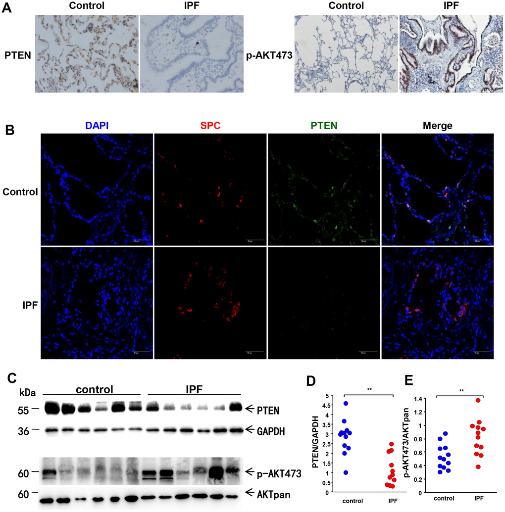 Loss of PTEN and activation of the AKT pathway in lung tissue from IPF patients. (A) Representative results of IHC staining for PTEN and p-AKT 473 in lung tissues (original magnification, 200× for PTEN and 100× for p-AKT 473). (B) Immunofluorescence staining for both SP-C (red) and PTEN (green) were conducted to examine the spatial distribution of PTEN (original magnification, 200×). (C–E) Western blot analysis was applied to detect the expression of PTEN and activation of the AKT pathway. Each dot represents an individual lung tissue. **p 