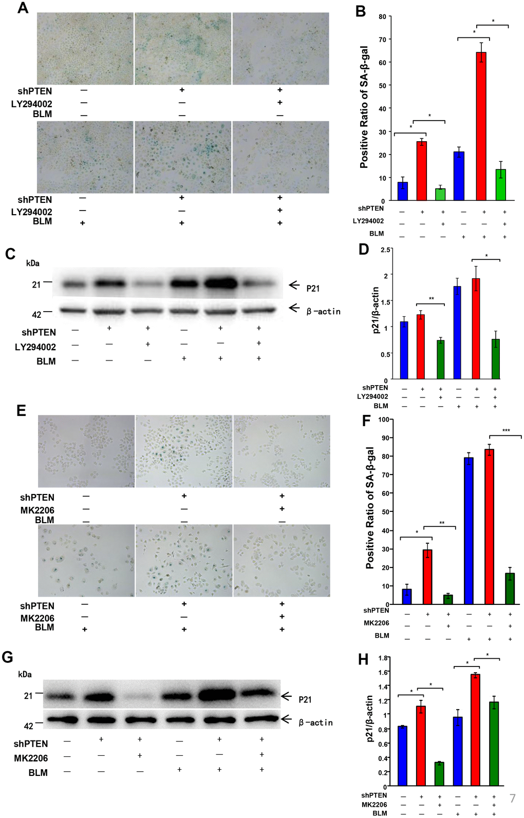 Akt inactivation rescues AEC senescence in vitro. After PTEN was stably knocked down, an inhibitor of the AKT pathway (20 μm/L LY294002 or 5 μg/ml MK2206) was added 1 hour before bleomycin (10 μg/ml) to A549 cells for 72 hours followed by a fresh medium transfer for 24 hours. (A, B) Rescue of cell senescence by LY294002 was determined by SA-β-Gal staining (original magnification, 200×), and decreased expression of P21WAF1 (C, D) was confirmed by western blot. Rescue of cell senescence by MK2206 was determined by SA-β-Gal staining (E, F) and P21WAF1 expression (G, H). Data are shown as the mean ± SEM, n ≥ 3 per group. *p p 