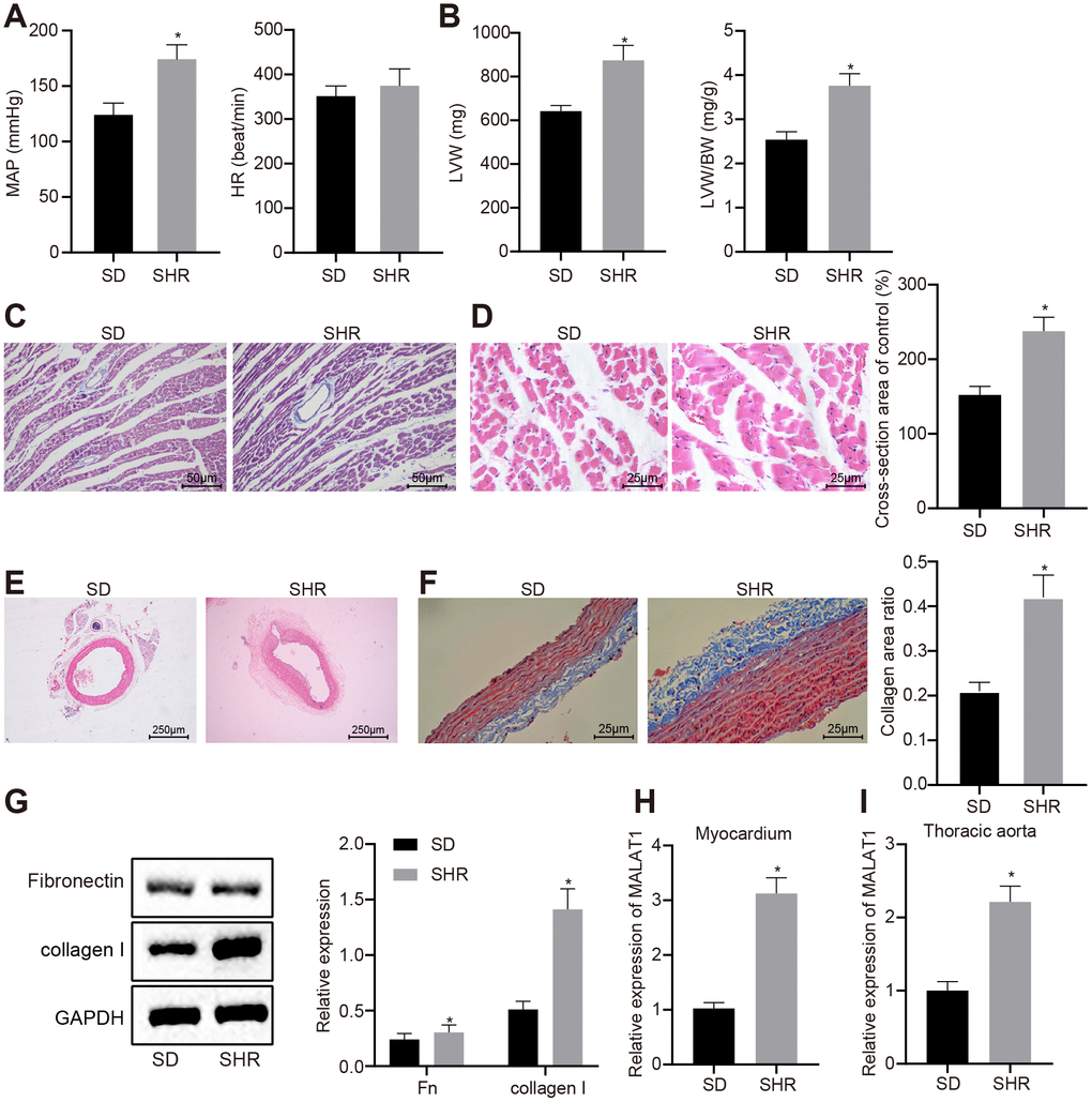 LncRNA MALAT1 is up-regulated in hypertensive rats. (A) MAP and HR of SD and SHRs; (B) LVW and LVW/BW ratio in SD and SHRs; (C) images of myocardial tissues observed by Masson staining (scale bar = 50 μm); (D) images of myocardial tissues detected by HE staining (scale bar = 25 μm); (E) pathological changes of thoracic aortic vascular tissues in SD rats and SHRs observed using HE staining (× 40); (F) collagen deposition in thoracic aortic vascular tissues in SD rats and SHRs observed using Masson staining (× 400); (G) the expression of fibronectin and collagen I in vascular tissues of SD rats and SHRs, tested by Western blot analysis; (H–I) the expression of lncRNA MALAT1 in myocardial tissues (H) and thoracic aortic vascular tissues (I) in SD rats and SHRs, tested by RT-qPCR; *, p vs. the SD rats; measurement data were expressed by means ± standard deviation and analyzed by unpaired t-test; SD rats = 30, SHRs = 10.