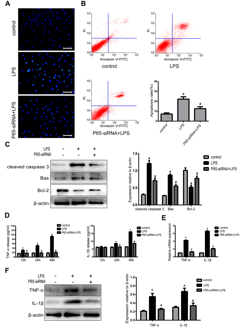 Inhibiting NF-κB decreases apoptosis and inflammatory in LPS-induced NPCs. (A) Morphologic changes in apoptotic NP cells were stained by Hoechst 33258 (Amplification ×200). (B) Apoptotic cells were stained with Annexin V-PE and PI, and analyzed by flow cytometry. (C) Western blot analysis for the protein expression of cleaved caspase 3, Bax and Bcl-2. (D) The expression of TNF-α and IL-1β in NPCs supernatant was measured by ELISA. (E) Real-time PCR analysis for the protein expression of TNF-α and IL-1β. (F) Western blot analysis for the protein expression of TNF-α and IL-1β. Values are means ±SEM.*p#p