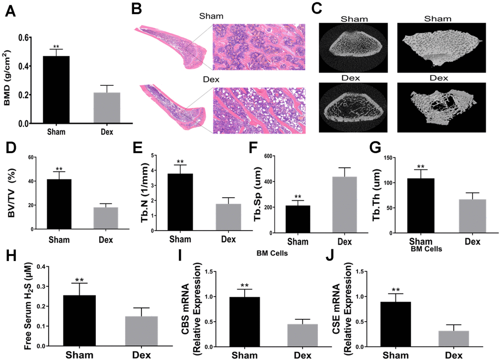 Dexamethasone induced osteoporosis and downregulated serum H2S and mRNA expressions of CBS and CSE in BM SCs. (A) BMD in the distal end of the intact femurs of each experimental group. n=5, **pB) Hematoxylin-eosin staining was performed to identify histological structures of the distal end of the intact femurs of rats injected with Dex for 4 weeks. Scale bars are 50 μm. (C) Representative figures of micro-CT analysis of the distal end of the intact femurs of rats treated with Dex. (D) BV/TV in the distal end of the intact femurs of each experimental group. n=5, **pE) Tb.N in the distal end of the intact femurs of each experimental group. n=5, **pF) Tb.Th in the distal end of the intact femurs of each experimental group. n=5, **pG) Tb.Sp in the distal end of the intact femurs of each experimental group. n=5, **pH) Effects of Dex on serum H2S. n=5, **pI–J) Effects of Dex on mRNA expressions of CBS and CSE in BMSCs. n=5, **p