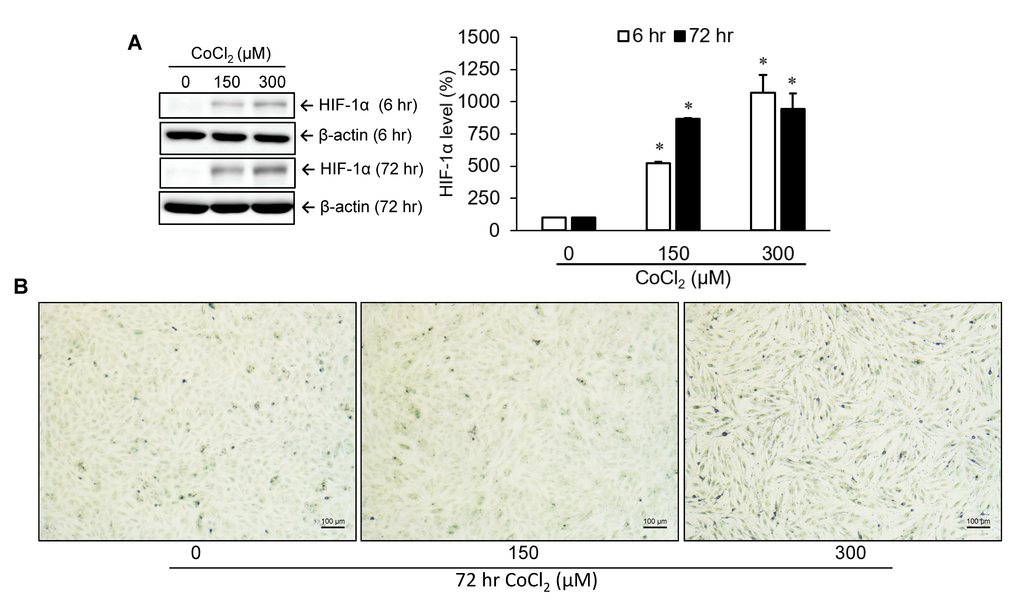 Identification of cellular senescence. A10 cells were incubated with various doses of cobalt dichloride (CoCl2) for 6 and 72 hr. The protein level of hypoxia-inducible factor (HIF)-1α was analyzed using Western blotting (A). Senescent cells were detected by cytochemical staining of SA-β-gal activity which appeared as a blue-green color (B). * p 2 treatment.