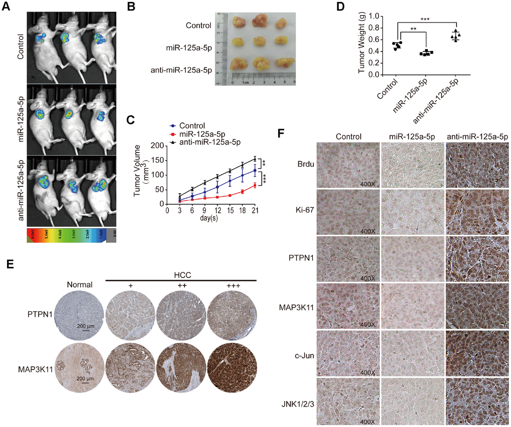 miR-125a-5p suppresses cell proliferation and induces apoptosis by targeting PTPN1 and MAP3K11 via the MAPK signaling pathway in vivo. (A and B) Representative images of mice and xenografted tissues. (C and D) Xenograft tissue volumes and weights were analyzed (n=5). Two- and One-way ANOVAs, mean ± SD. **PPE) PTPN1 and MAP3K11 expression was higher in HCC tumor tissues than in normal liver tissues in the Human Protein Atlas database. (F) Brdu, Ki67, PTPN1, MAP3K11, JNK1/2/3, and c-Jun expression were detected via immunofluorescence in xenografted tissuesat 400× magnification.