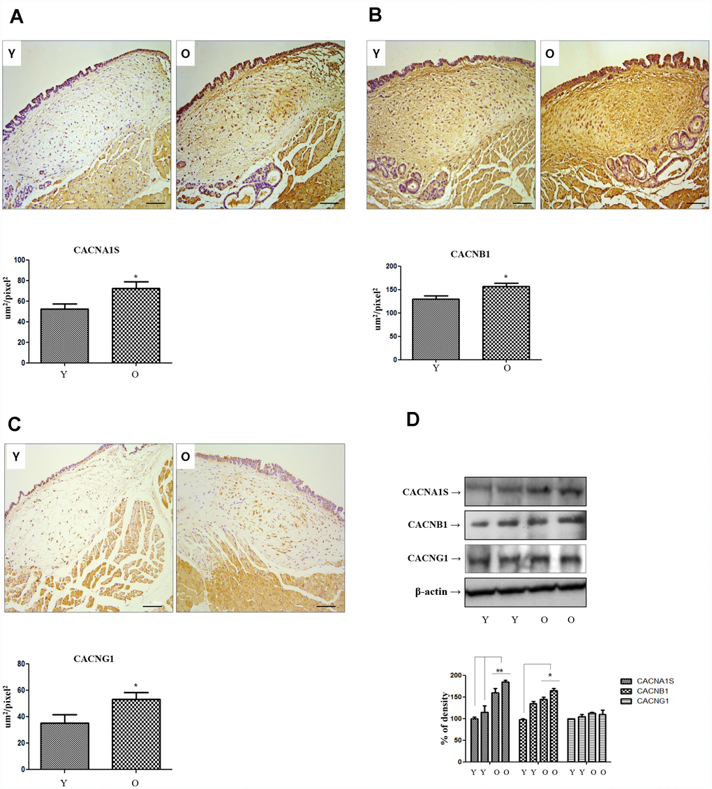 Immunohistochemistry of CACNA1s, CACNB1 and CACNG1 genes. Expression of CACNA1S (A), CACNB1 (B) and CACNG1 (C) in IHC staining finding (X200) increase significantly in old compared to young rats. In western blot analysis of these 3 genes, only CACNA1S is increased in primary cultured lamina propria fibroblasts of old compared to young rats (D). IHC, Immunohistochemistry. One-way ANOVA test; *p