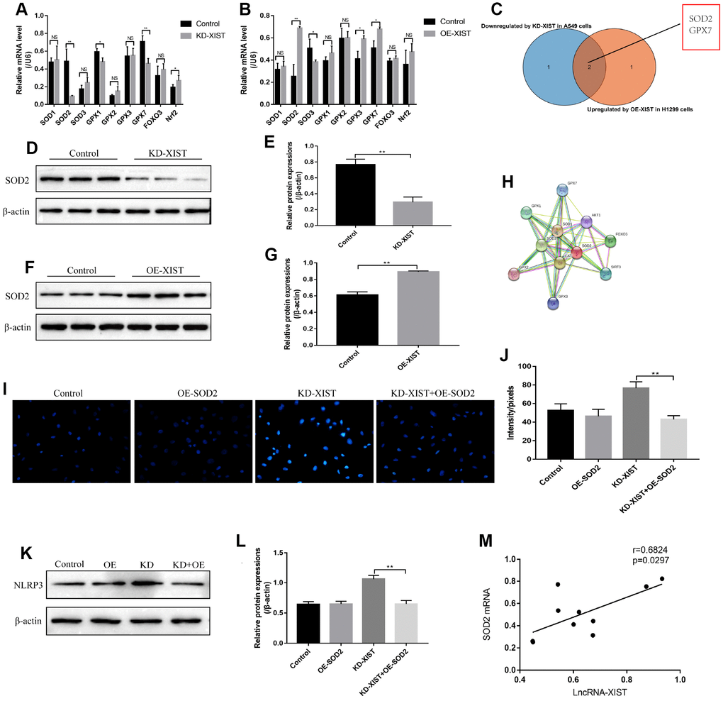 The role of SOD2 in LncRNA-XIST regulated cell pyroptosis and ROS generation. (A) Real-Time qPCR was used to detect the levels of anti-oxidant genes in A549 cells. (B) Real-Time qPCR was used to detect the levels of anti-oxidant genes in H1299 cells. (C) Venn diagram showing the overlapped genes downreglated in A549 cells and upregulated in H1299 cells. Western Blot was used to detect SOD levels in (D) A549 cells and (F) H1299 cells, which were normalized to β-actin and (E, G) quantified by Image J software. (H) STRING software was used to conduct co-expression analysis of SOD2. (I, J) DHE staining was used to detect ROS levels in A549 cells. (K) NLRP3 levels were detected by Western Blot in A549 cells, which were normalized to β-actin and (L) quantified by Image J software. (M) Pearson analysis was conducted to analyse the correlation between LncRNA-XIST and SOD2 mRNA levels tin NSCLC tissues. (“NS” represented no statistical significance, “*” represented p p 