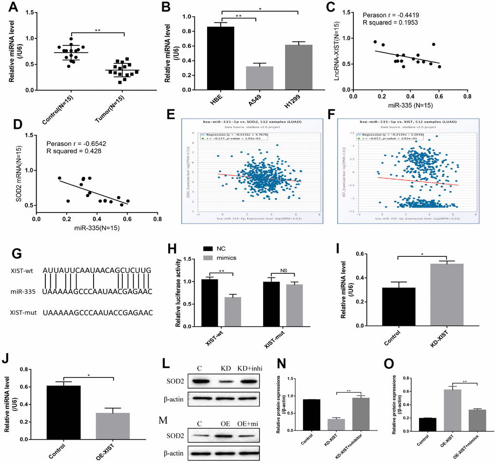 LncRNA-XIST regulated SOD2 levels by targeting miR-335. (A) Real-Time qPCR was used to detect miR-335 levels in NSCLC tissues. (B) miR-335 levels were detected in NSCLC cell lines. (C) Pearson analysis was used to evaluate correlation of miR-335 and LncRNA-XIST in NSCLC tissues (N=15). (D) Pearson analysis was used to evaluate correlation of miR-335 and SOD2 mRNA levels in NSCLC tissues (N=15). (E, F) Pan-cancer analysis was used to analyse the correlation of LncRNA-XIST, miR-335 and SOD2 expression levels in lung adenocarcinoma. (G) Sequence alignment of miR-335 with the putative binding sites with in the wild-type regions of LncRNA-XIST. (H) Dual-luciferase reporter gene system was conducted to investigate the targeting relationship between LncRNA-XIST and miR-335. (I, J) The effects of LncRNA-XIST on miR-335 were detected by Real-Time qPCR in A549 and H1299 cells respectively. (L, N) Knock-down (KD) of LncRNA-XISt regulated SOD2 levels in A549 cells by targeting miR-335. (M, O) Overexpressed (OE) LncRNA-XIST regulated SOD2 levels in H1299 cells by targeting miR-335. (“NS” represented no statistical significance, “*” represented p p 