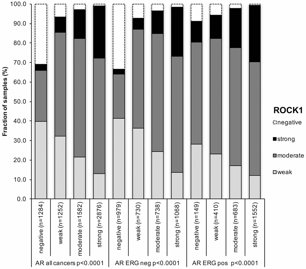 Association between positive ROCK1 staining and androgen-receptor (AR) status in all cancer, ERG fusion negative and ERG fusion positive cancers.