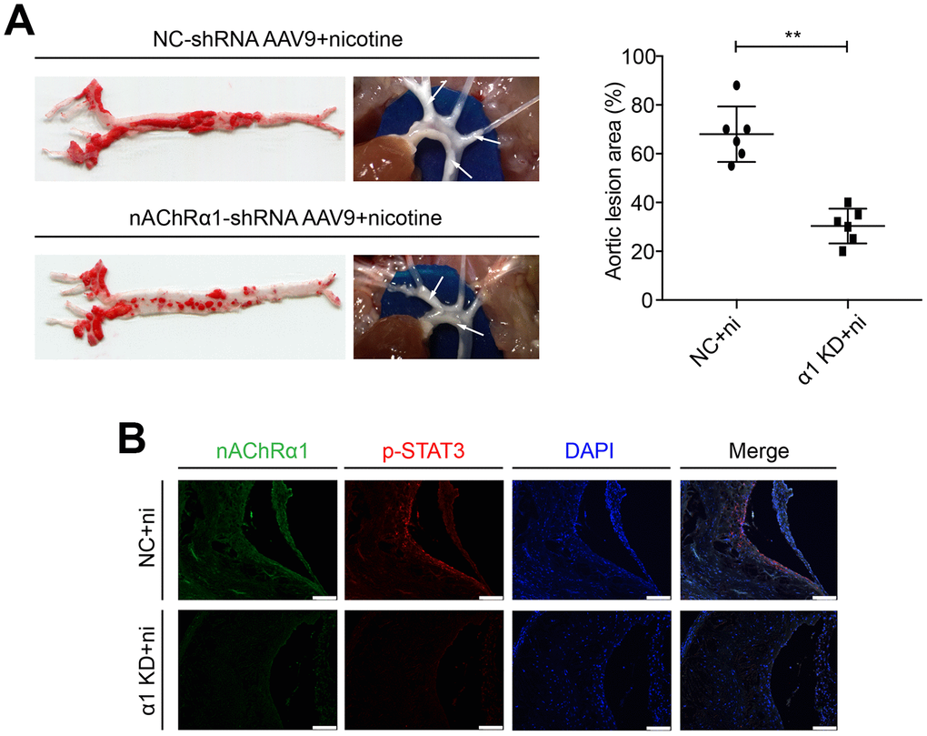 nAChRα1 is involved in nicotine-induced atherosclerosis by mediating STAT3 phosphorylation in vivo. (A) nAChRα1 knockdown attenuates nicotine-induced atherosclerotic progression in vivo. Arrow means atherosclerotic lesion. (B) nAChRα1 knockdown significantly decreases the nicotine-induced upregulation of p-STAT3. Magnification, 200×; bars, 100 μm. Abbreviations: α1 KD, nAChRα1 knockdown; NC, negative control; ni, nicotine. The data were presented as the mean ± SD, *p p 