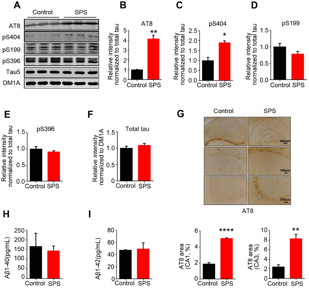 SPS-induced PTSD leads to tau hyperphosphorylation at specific sites, but doesn’t alter Aβ1-40 and/or Aβ1-42 production. (A) Hippocampal protein levels of total tau, p-tau at Ser199, Ser202/Thr205(AT8), Ser396 and Ser404 were measured by WB. (B and C) Statistical analysis showed a marked increased at AT8(Ser202/Thr205) and Ser404 in SPS rats. (D and E) Statistical analysis of the level of pS199 and pS396 showed no significant differences between the two groups. (F) Total tau (tau5) normalized by DM1A. (G) Immunohistochemistry showed the increased distribution of AT8 compared to control (upper row scale bar=500μm, middle and lower row scale bar=100μm). (H and I) Measurement of Aβ1-40 and Aβ1-42 by ELISA kits in hippocampus. All data represent mean ± SEM, n=3, *P 