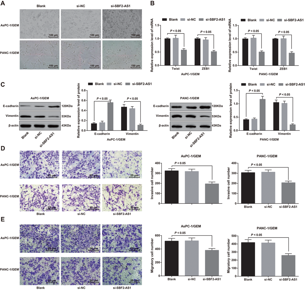 Effect of knock-down of SBF2-AS1 expression on epithelial-mesenchymal transition, invasion and migration of drug-resistant pancreatic cancer cells. (A) The morphology of cells is observed by an inverted microscope (× 100). (B) The mRNA expression of transcriptional factors Twist and ZEB1 in EMT detected by RT-qPCR. (C) The expression of E-cadherin and Vimentin detected by western blot analysis. (D) The invasion ability of AsPC-1/GEM and PANC-1/GEM cells determined by Transwell assay (× 400). (E) The migration ability of AsPC-1/GEM and PANC-1/GEM cells determined by Transwell assay (× 400). Repetitions = 3; Data was analyzed using one-way ANOVA.