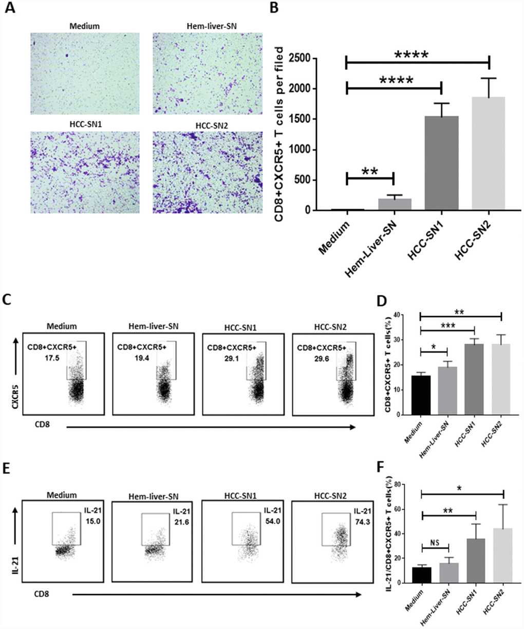 Differentiation and chemotaxis of CD8+CXCR5+ T cells is induced by HCC-SN cells. (A–B) Culture supernatants from primary HCC cell cultures (HCC-SN1 and HCC-SN2 cells), but not normal liver cultures (Hem-liver-SN cells), induce chemotaxis of healthy blood CD8+CXCR5+ T cells sorted by FACS (n=3). (A) One representative experiment is shown. (B) The data indicate the mean±SD. (C–E) HCC-SN1 and HCC-SN2 cells, but not Hem-liver-SN cells, are able to induce the CD8+CXCR5+ or IL-21+ CD8+CXCR5+ phenotype in healthy blood CD8+ T cells (n=3). The results shown represent four separate experiments. The data indicate the mean±SD. *PPP****P0.0001 determined using student’s t test (B, D and F).