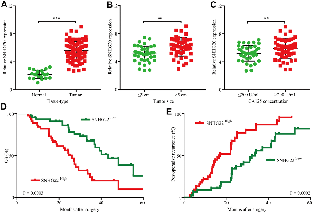 The upregulation of SNHG22 predicts poor outcome in EOC patients. (A) Expression levels of SNHG22 in 90 cases of EOC patient tissues and 20 cases of normal ovarian tissues. (B) Ninety patients were divided into ≤5 cm and >5 cm size groups. The diagram shows SNHG22 expression in each group. (C) Ninety patients were divided into ≤200 U/mL and >200 U/mL CA125 groups. The diagram shows SNHG22 expression in each group. (D and E) Kaplan-Meier analysis of overall survival and recurrence in 90 patients with EOC according to SNHG22 expression (log-rank test). Data are presented as the means ± SDs in three independent experiments. **P 