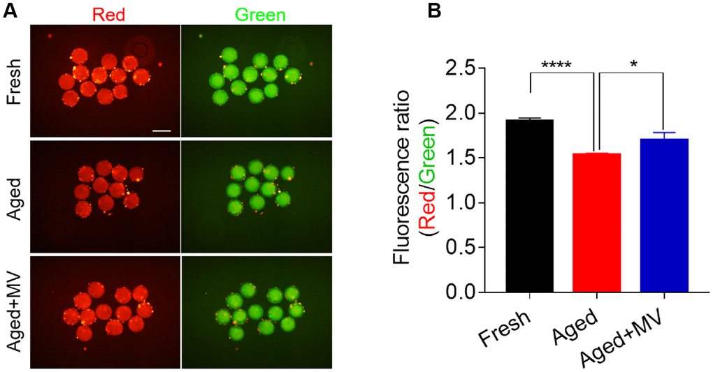 Effect of mogroside V on the mitochondrial membrane potential in oocytes during in vitro ageing. After in vitro maturation for 44 h, oocytes that extruded the first polar body were continuously cultured in vitro with or without MV for 24 h. (A) Representative images of fresh, aged and aged+MV oocytes stained with JC-1. (B) Quantitative analysis of JC-1 fluorescence intensity. The data are presented as the mean ± SEM of at least three independent experiments. Mogroside V, MV; Scale bar = 200 μm. * PP