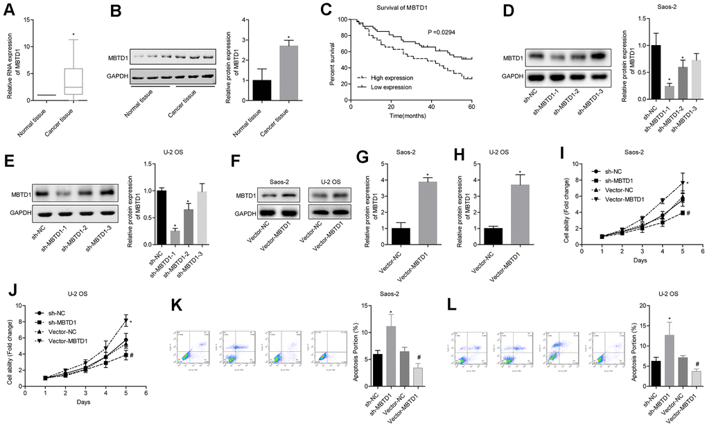 MBTD1 is highly expressed in osteosarcoma and associated with poor prognosis, and MBTD1 promotes cell viability and inhibits apoptosis. (A, B) The expression level of MBTD1 in osteosarcoma tissues and adjacent tissues is shown. © 5-year survival analysis of osteosarcoma patients with different MBTD1 levels is shown. (D–H) The effects of MBTD1 knockdown or overexpression on MBTD1 protein expression levels are shown. (I–L) The effect of knockdown or overexpression of MBTD1 on cell viability and apoptosis is shown. *P #P 