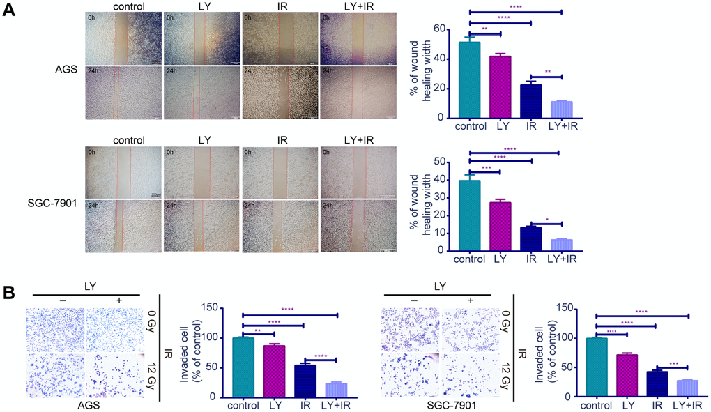 Effects of LY on the migration and invasion abilities of irradiation induced GC cell lines. (A) Cell migration assay: captured images of wound healing assay in GC cells influenced by LY with or without irradiation treatment, columns indicated the percentage of wound healing width in four groups. (B) Cell invasion assay: captured images of transwell assay in GC cells influenced by LY with or without irradiation treatment, columns indicated the invaded cell percentage in four groups. All data represent three independent experiments, mean ± SEM, *P0.05, **P0.01, ***P0.001, ****P0.0001.