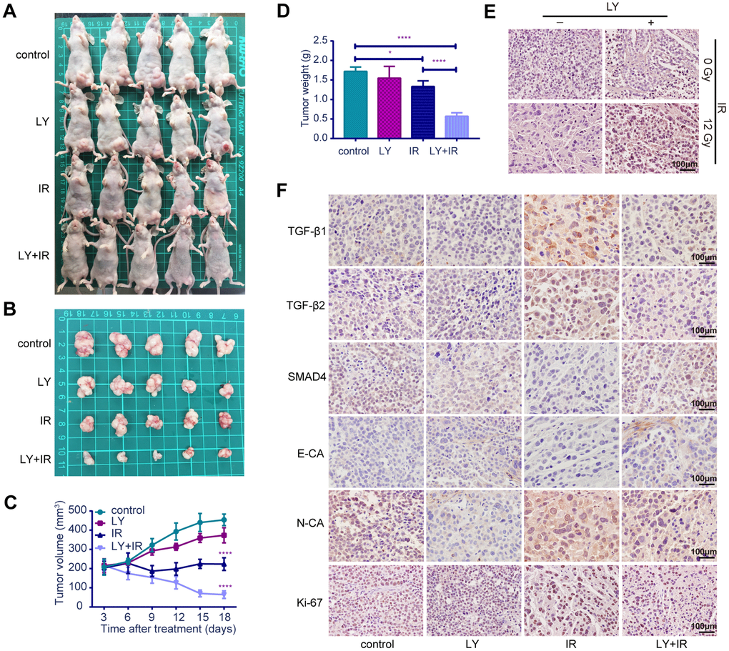 Effects of LY on radiosensitivity of gastric cancer in vivo. (A and B) Changes in tumor sizes: images of BALB/c nude mice with tumors and resected tumors after LY with or without irradiation treatment. (C) Changes in tumor volumes: the statistical curves of gastric tumor volumes influenced by LY with or without irradiation treatment. (D) Changes in tumor weights: the final tumor weight after LY with or without irradiation treatment for 18 days. (E) TUNEL assays: representative images of the apoptostic cells in GC xenografts influenced by LY with or without irradiation treatment. (F) Changes in genetic expression in GC xenografts: the immunohistochemical analysis of the TGF-β1, TGF-β2, SMAD4, E-CA, N-CA and Ki-67 expressions in GC xenografts influenced by LY with or without irradiation treatment. Original magnification, ×400. *P0.05, ****P0.0001.