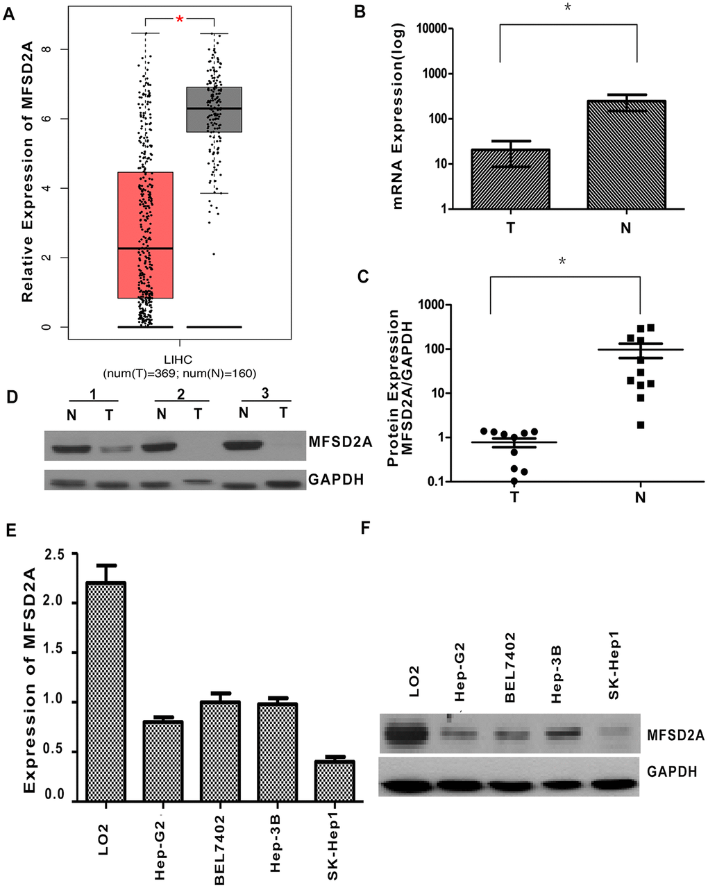 Decreased expression of MFSD2A in HCC. (A) The expression of MFSD2A in HCC and normal liver tissues was analyzed in the TCGA and GTEx databases (P B) RT-qPCR showed that the relative mRNA expression of MFSD2A in HCC tissues was decreased compared with that in the matched adjacent nontumorous tissues (n = 24, *P = 0.016). (C) Densitometric analysis of MFSD2A protein levels relative to GAPDH in HCC and corresponding normal liver samples. The expression of MFSD2A was reduced in tumor tissues when compared with that in corresponding nontumorous tissues (n = 11, *P = 0.0472). (D) The protein level of MFSD2A in HCC and corresponding nontumorous specimens was tested by western blotting. GAPDH was used as a loading control. RT-qPCR (E) and western blotting (F) were used to analyze the expression of MFSD2A in several HCC cell lines and one immortalized hepatic cell line LO2.