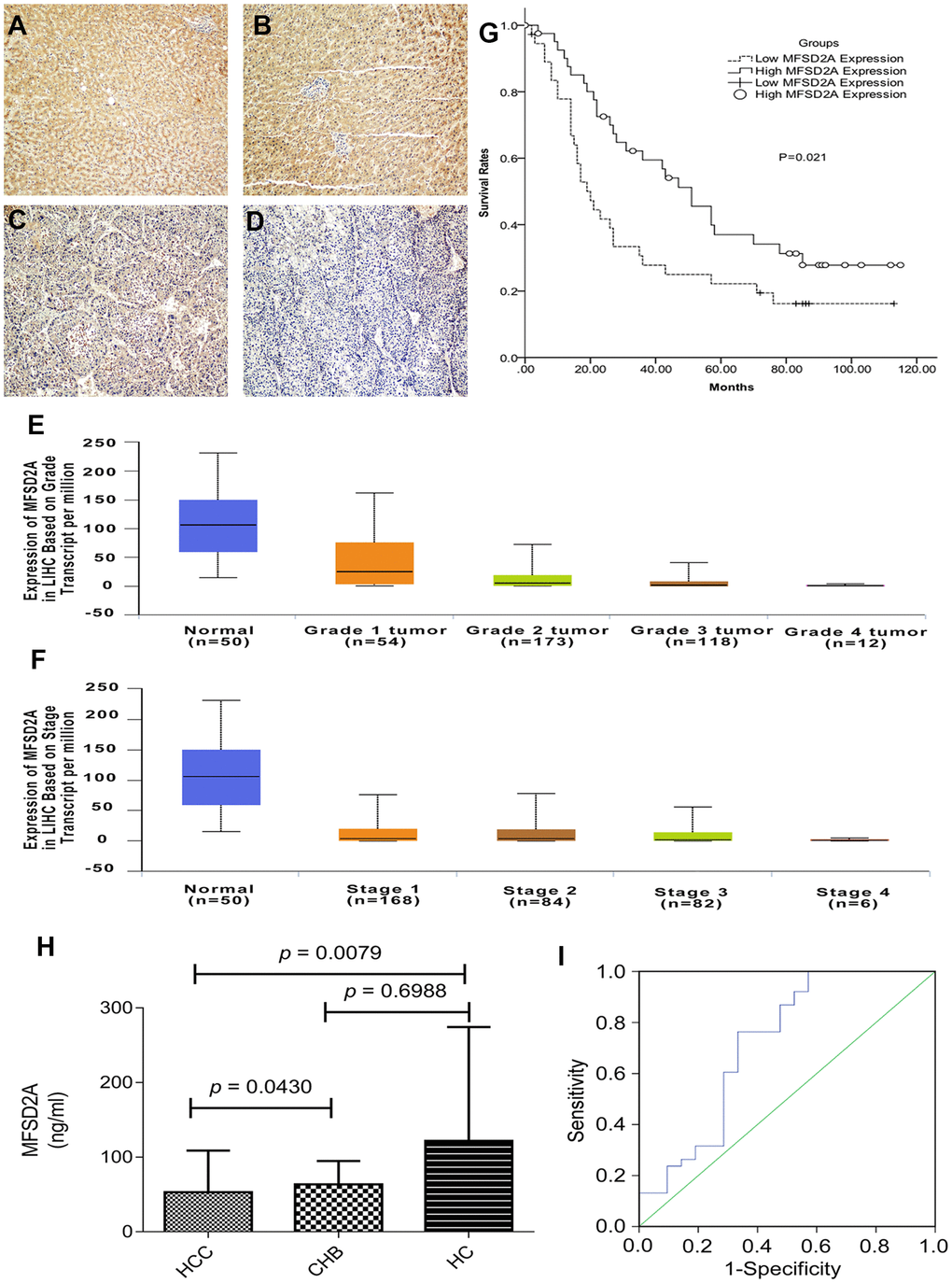 MFSD2A expression and clinical values. (A, B) High expression level of MFSD2A (200×magnification); (C) low expression level of MFSD2A (200×magnification); (D) negative expression of MFSD2A (200×magnification). Low expression of MFSD2A was significantly correlated with tumor grade (E) and stage (F) analyzed with UALCAN database. The lower expression level of MFSD2A represented higher stage and pathological grade. (G) Patients expressing higher levels of MFSD2A show significantly better five-year overall survival (P = 0.021). Survival curves of 79 HCC patients with different MFSD2A expression are shown. Kaplan-Meier survival curves for high expression of MFSD2A group were significantly different (P=0.021, log-rank test) from low MFSD2A expression group in 79 HCC patients. Diagnostic outcomes for plasma MFSD2A in the diagnosis of HCC (H) MFSD2A concentrations in plasma. (I) ROC curve for MFSD2A with HCC versus HC and CHB. MFSD2A=Major Facilitator Superfamily Domain Containing 2A, HCC=hepatocellular carcinoma, CHB=chronic hepatitis B virus infection, HC=healthy control.