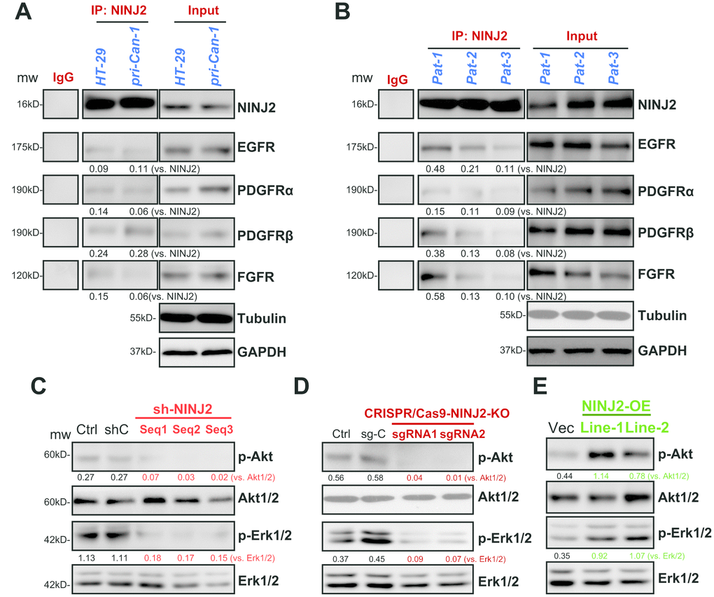 NINJ2 forms a complex with multiple receptor tyrosine kinases (RTKs) in CRC cells and colon cancer tissues. In HT-29 cells and primary human colon cancer cells (“pri-Can-1”) the associations between NINJ2 with multiple RTKs (EGFR, PDGFRα, PDGFRβ and FGFR) were tested by co-immunoprecipitation (Co-IP) assays (A); “Input” shows expression of RTKs and NINJ2 in total cell lysates (A). Fresh human colon tissue lysates from patient-1/-2/-3/ (“Pat-1/2/3”) were subjected to the same Co-IP assay of NINJ2-RTKs associations (B), “Input” shows expression of RTKs and NINJ2 in lysates (B). Expression of the listed proteins in stable HT-29 cells with applied NINJ2 shRNA (“Seq1/2/3”) or non-sense control shRNA (“shC”) were shown (C). Stable HT-29 cells with the lenti-CRISPR/Cas9-KO constructs (with NINJ2 sgRNA1/2, (D) or NINJ2 cDNA construct (“NINJ2-OE”, two lines, E) were subjected to the same Western blotting assay of listed proteins. NINJ2-bound RTKs (EGFR, PDGFRα, PDGFRβ and FGFR) were quantified (A and B). Akt and Erk phosphorylations were normalized to total proteins (C–E). Experiments in this figure were repeated three times, and similar results were obtained.