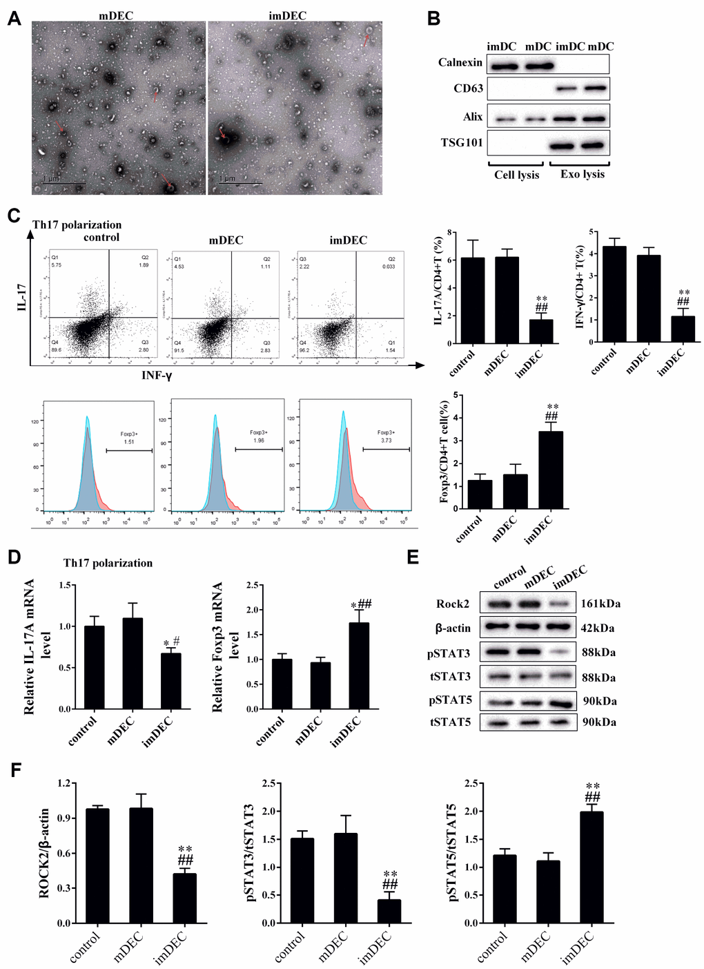 imDEC suppressed the IL17+CD4+T cells and promoted the Foxp3+CD4+T cells. (A) imDECs and mDECs from imDCs and mDCs were determined by transmission electron microscope (TEM). (B) Western blot showed the Calnexin, exosome markers CD63, Alix and TSG10 expressions in cell lysis and exo lysis of imDCs and mDCs. (C) Primary CD4+T cells were collected from the spleen. Under Th17 polarization condition, the percentage of IL17+CD4+T cells and IFN-γ+CD4+T cells were detected in control, mDEC and imDEC groups. (D) The mRNA transcription of Foxp3 and mRNA transcription of IL-17A were detected in control, mDEC and imDEC groups under Th17 polarization condition for 72 h. (E–F) The expressions of p-STAT5, p-STAT3 and ROCK2 were detected in control, mDEC and imDEC groups. *P